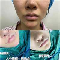 李涛医生