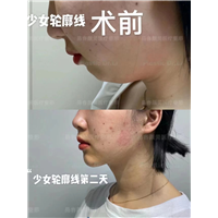 李涛医生