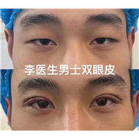易容颜美李医生