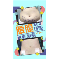 西安腰部抽脂整形 