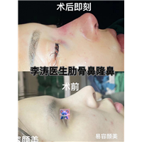 易容颜美李医生