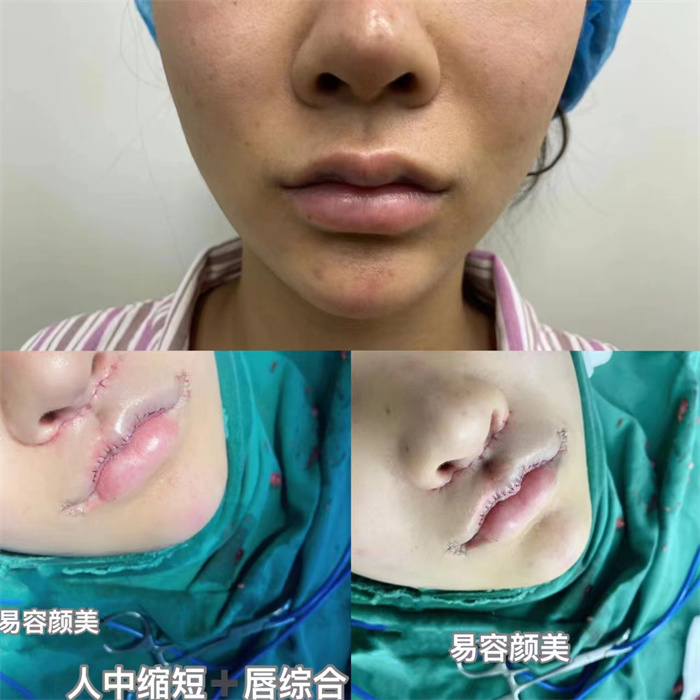 李涛医生