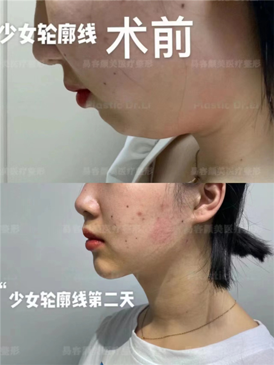 李涛医生