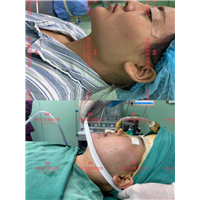 李涛医生