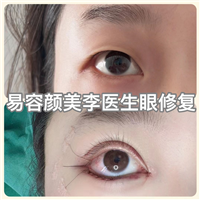 易容颜美李医生