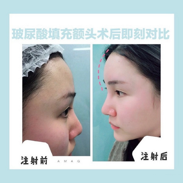西安网红全脸打造 