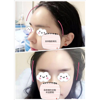 西安眼综合整形 