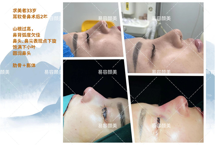 易容颜美李涛