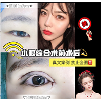 西安网红全脸打造 