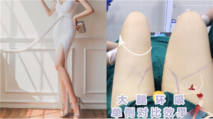西安专业整形修复 