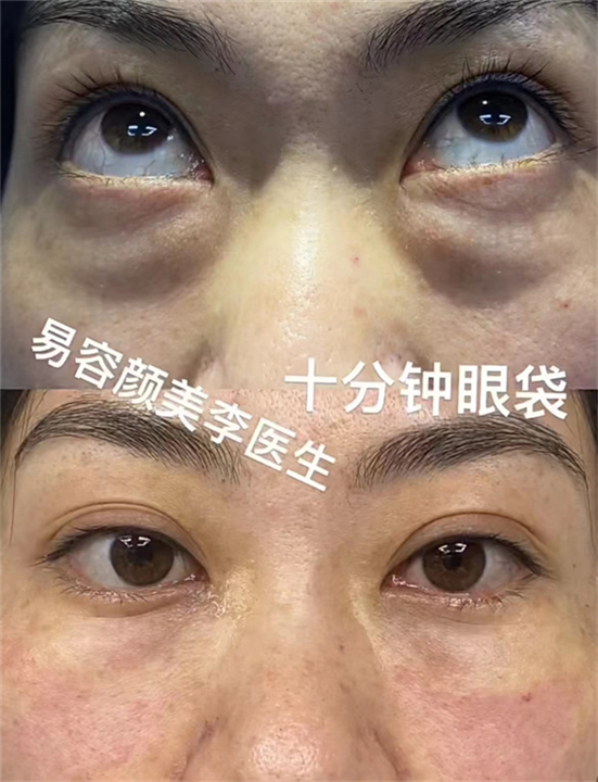 李涛医生