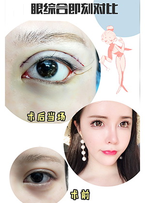 西安眼综合整形专家 