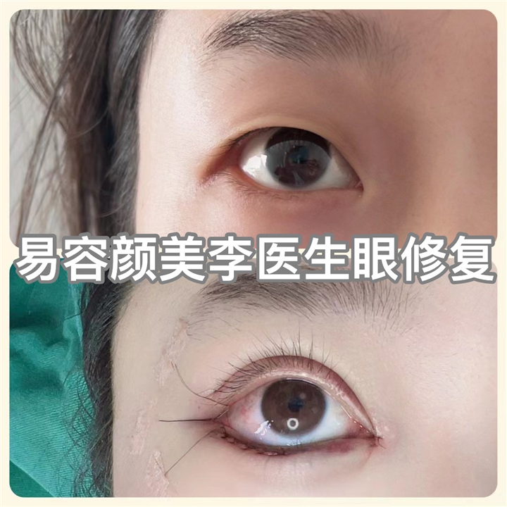 易容颜美李医生