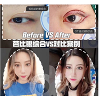 西安眼部整形专家 