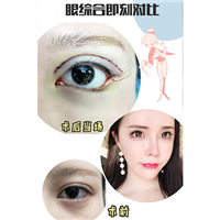 西安眼综合整形专家 