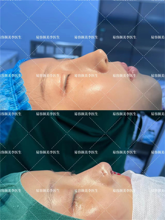 易容颜美李涛