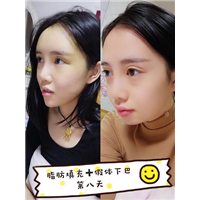 西安专业整形修复 