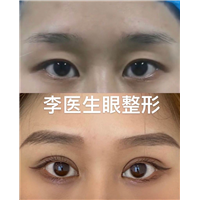 易容颜美李医生