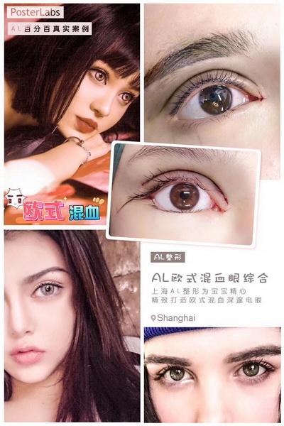 西安眼综合整形医院 