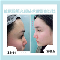 西安网红全脸打造 