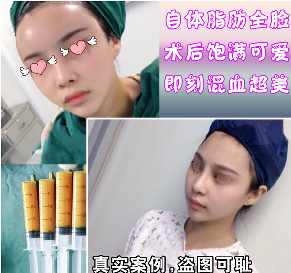 西安网红全脸打造 