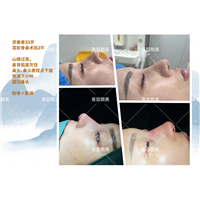 易容颜美李涛