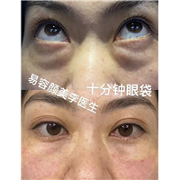李涛医生