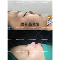 李涛医生