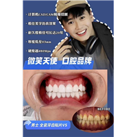 上海美牙,男士全瓷牙齿贴片