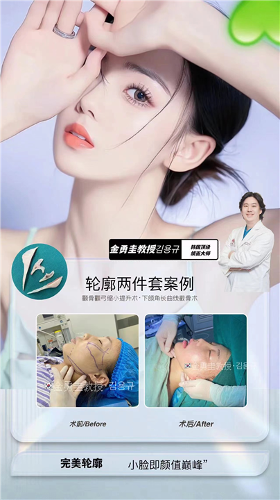 金勇圭教授轮廓两件套案例