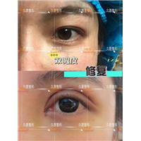 上海久愿整形怎么样&上海久愿整形修复
