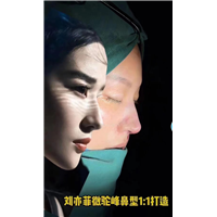 上海鼻整形医院安禾美阁