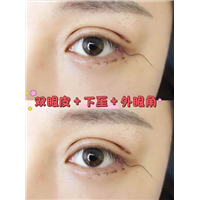 上海久愿整形修复&上海久愿整形在哪边