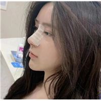 上海安禾美阁肋骨鼻整形