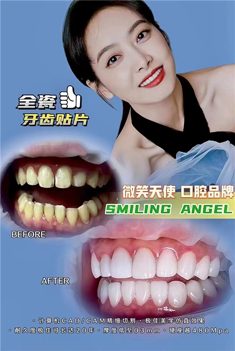 上海安禾美阁全瓷贴面美牙