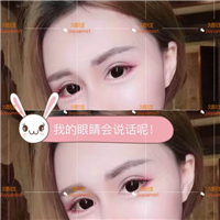 上海久愿整形怎么样&上海久愿整形修复