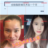 上海久愿整形&上海久愿整形怎么样