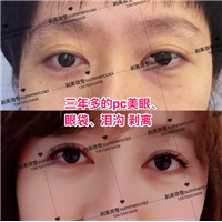 三年多的pc美眼