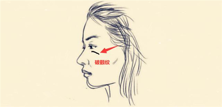 为什么印第安纹填充后会更严重？只因做错这一点