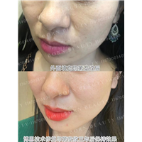 印第安纹有哪些类型？不同类型的印第安纹使用什么方法处理呢？