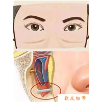 印第安纹到底是什么?怎么解决印第安纹？
