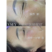 无针医美|无针医美是什么