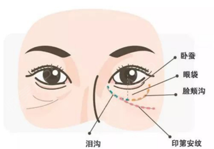 干货满满|印第安纹7大问题解答，赶紧收藏起来吧