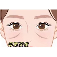 印第安纹剥离有哪些风险？印第安纹剥离有危险吗？