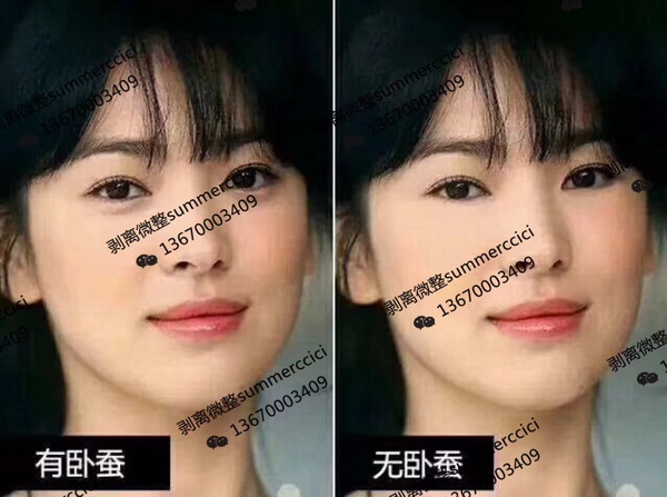 博恩汇美剥离美学