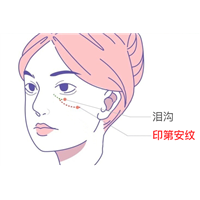 眼睛下面的皱纹是泪沟还是印第安纹？2个方法教你区分