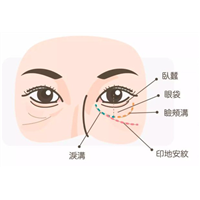 印第安纹在哪个部位？发现印第安纹怎么处理？