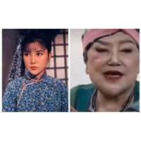 医源型印第安纹如何解决？李小龙好友邵音音脸上印第安纹逐渐淡化