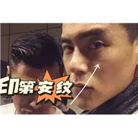 彭于晏脸上印第安纹形成原因分析，注意3件事
