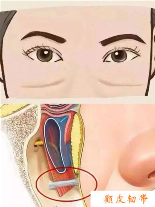 印第安纹到底是什么?怎么解决印第安纹？